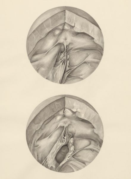 H.G Wetselaar, Two microscopic magnifications of parts of the heart