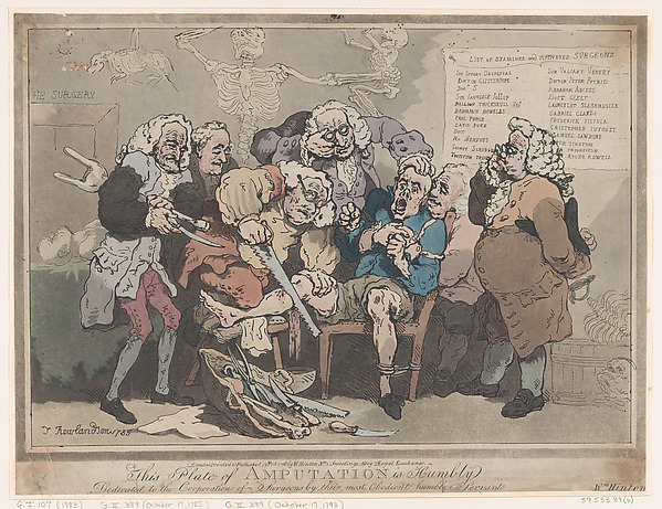 Thomas Rowlandson, Amputation