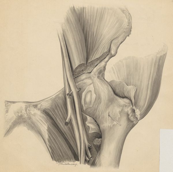 J Tinkelenberg, Musculoskeletal system of the hip