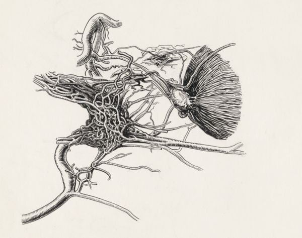 J Tinkelenberg, Circulatory system of the head