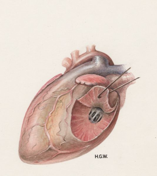 H.G Wetselaar, Heart and adjacent organs