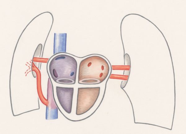J Wetselaar-Whittaker, Arteries of the heart and adjacent organs