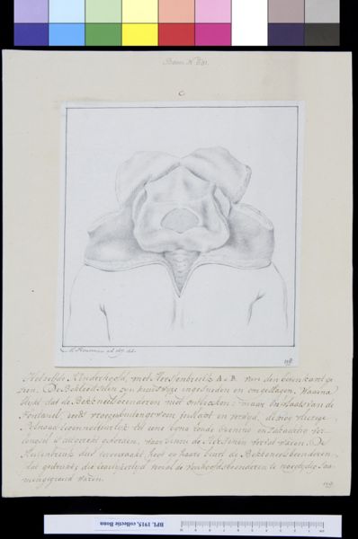 M Houtman, Deformed child, with fractured skull