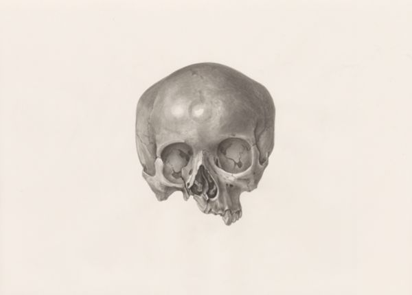 H.G Wetselaar, Deformed fetal head, seen from the front