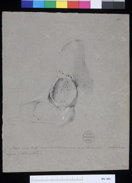 M. Houtman, Pathology, fractures (Acetabulum)