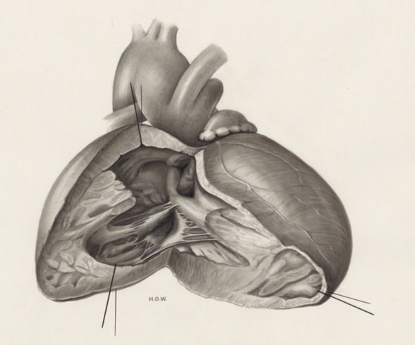 H.G Wetselaar, Heart and adjacent organs