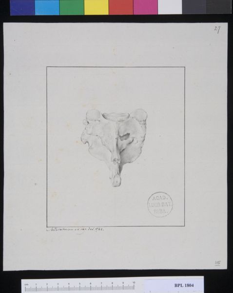 M Houtman, Pathology, fractures