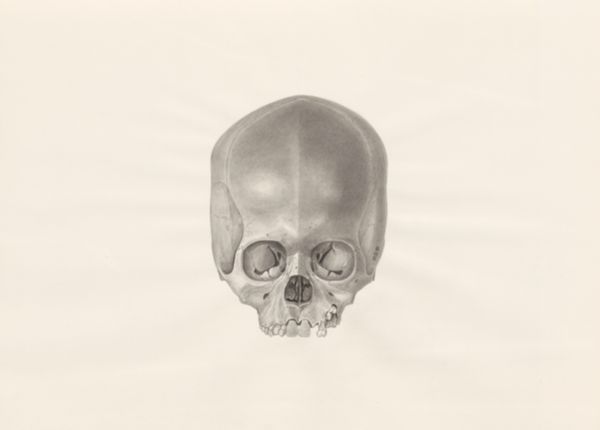 H.G Wetselaar, Deformed fetal skull