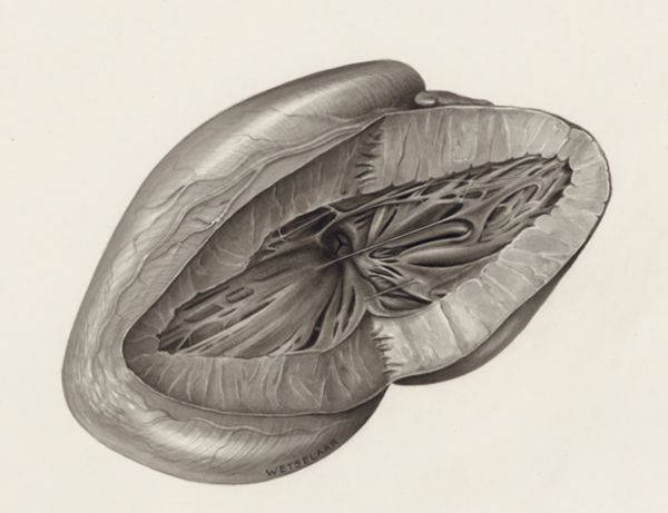H.G Wetselaar, Cross section of a heart