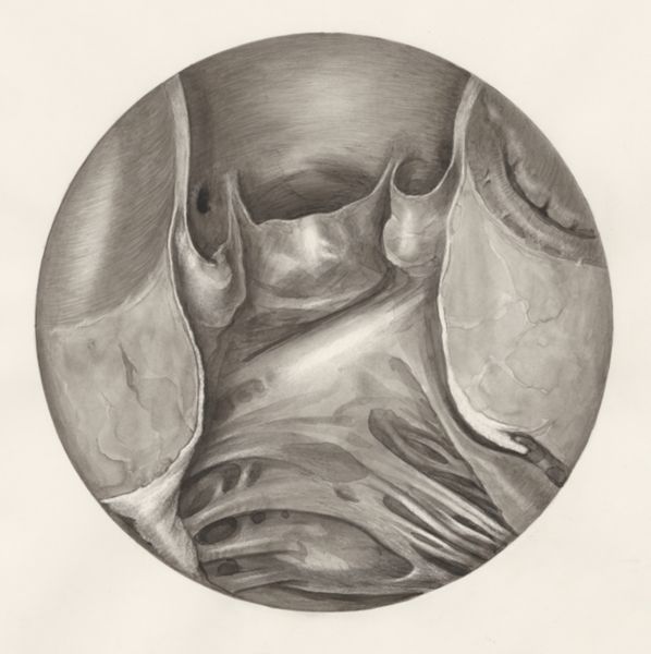 H.G Wetselaar, Microscopic magnification of the heart