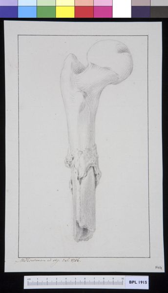 M Houtman, Infected bone (femur)