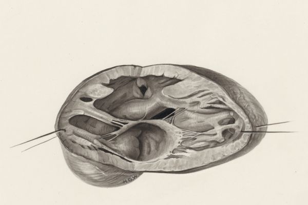 H.G Wetselaar, Heart and adjacent organs