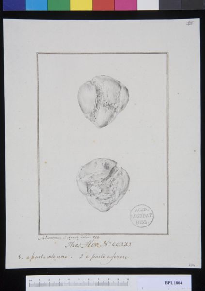 M Houtman, Pathology, fractures (Patella)