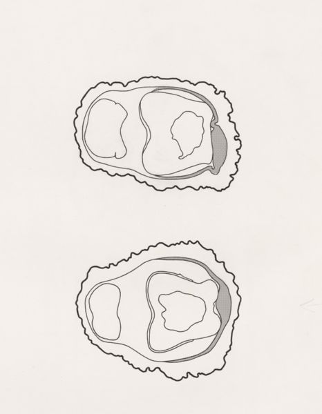 J Tinkelenberg, Schematic cross section of the fingers