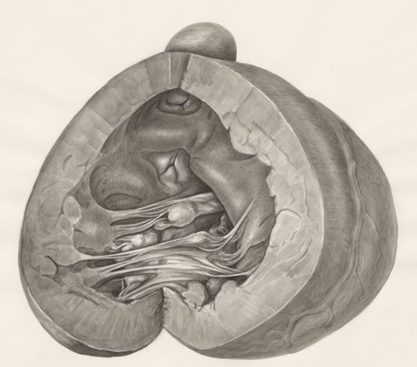 H.G Wetselaar, Heart