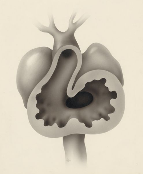 J Tinkelenberg, Embryonic heart