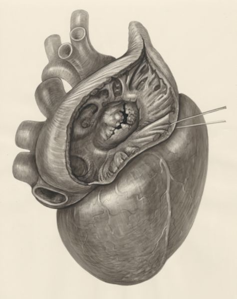 H.G Wetselaar, Heart