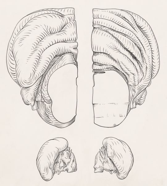 J Tinkelenberg, Reconstruction of the cerebellum