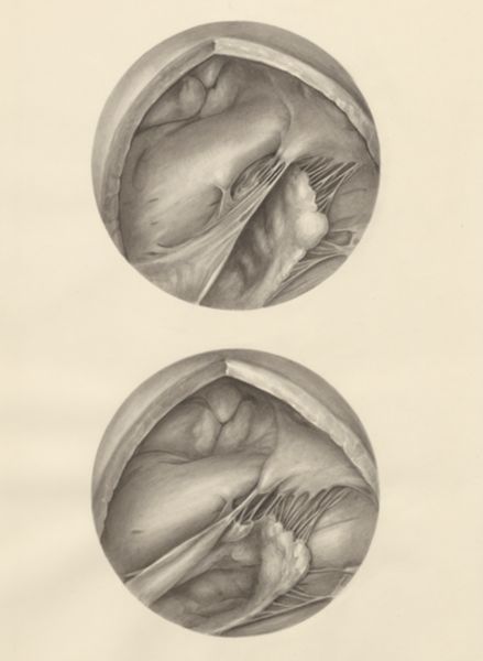 H.G Wetselaar, Two microscopic magnifications of parts of the heart