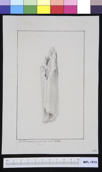M Houtman, Infected bone