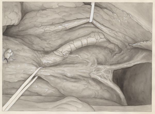 J Wetselaar-Whittaker, Human tissue