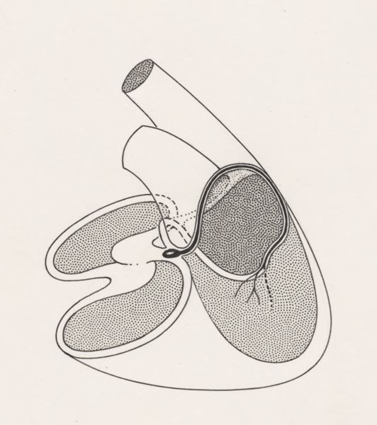 J Tinkelenberg, Schematic representation of the heart and circulatory system