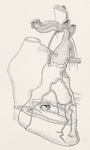 J Wetselaar-Whittaker, Human tissue