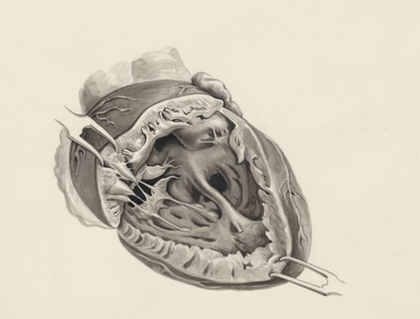 J Tinkelenberg, Embryonic heart