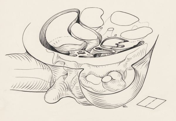 J Tinkelenberg, Cross section of the human embryo
