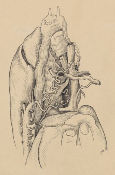 J Tinkelenberg, Part of the heart and circulatory system