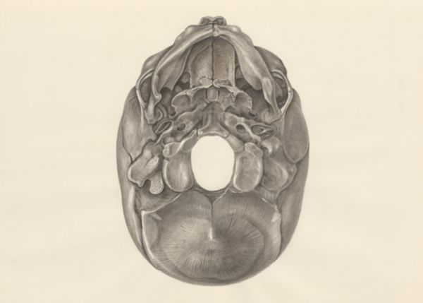 H.G Wetselaar, Deformed fetal skull, seen from below