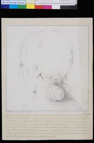 M Houtman, Spinal cord