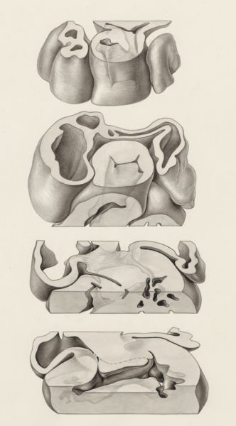 J Tinkelenberg, Coupes of the embryonic heart