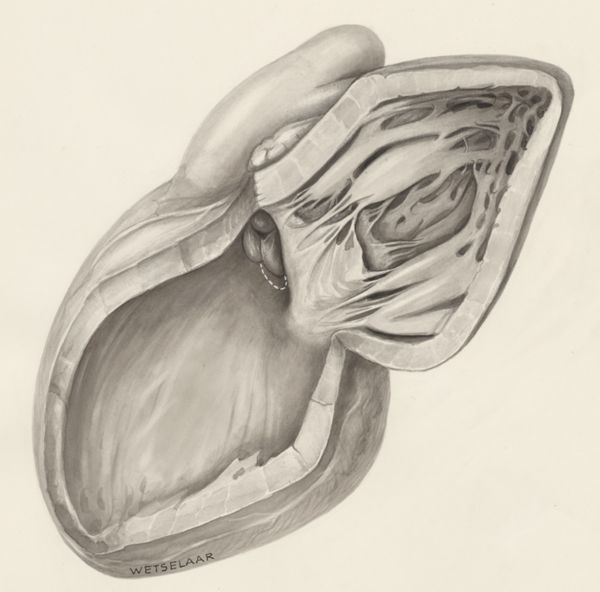 H.G Wetselaar, Heart