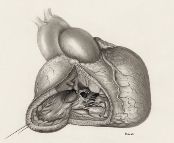 H.G Wetselaar, Heart