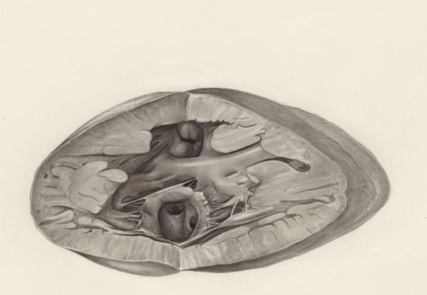 H.G Wetselaar, Heart and adjacent organs