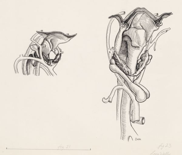 J Wetselaar-Whittaker, Tissue of the human throat, seen from two sides