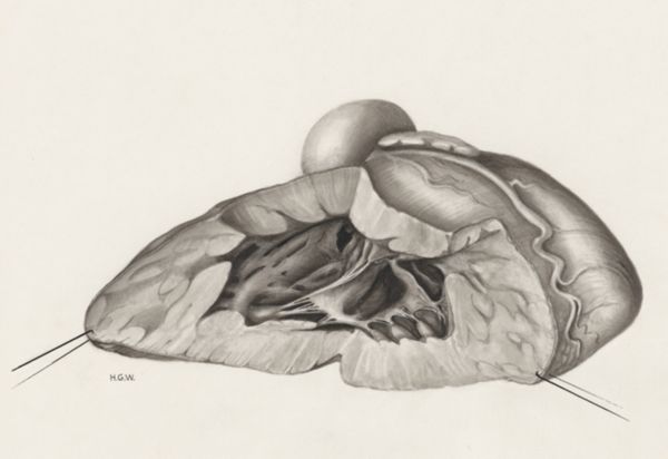 H.G Wetselaar, Heart and adjacent organs