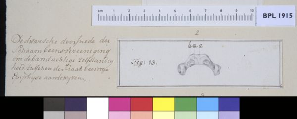 M Houtman, Pubis bone