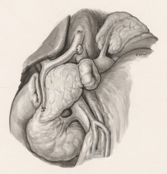 J Wetselaar-Whittaker, Human tissue