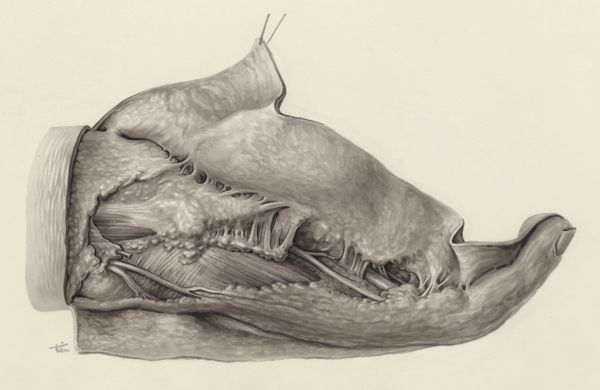 J Tinkelenberg, Muscular tissue of the hand and finger