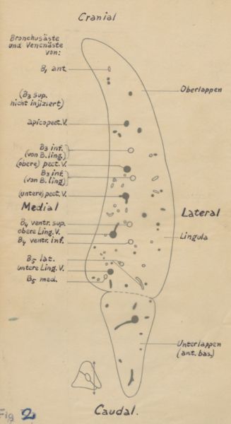 J Tinkelenberg, Cross section of the bronchi