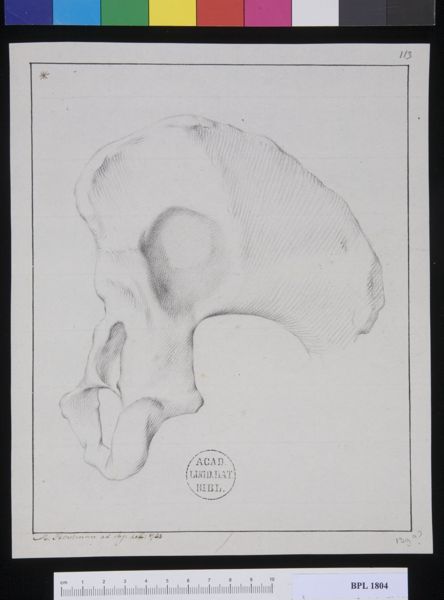 M Houtman, Pathology, fractures (Pelvis)