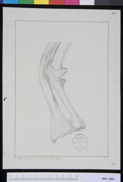 M. Houtman, Pathology, fractures (Forearm)