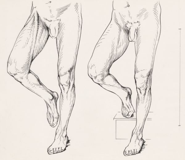 J Tinkelenberg, Movement of the male legs