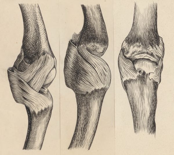 J Tinkelenberg, Joints of the hand or fingers