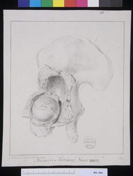 M Houtman, Pathology, fractures (Femur and hip)