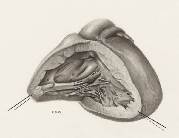 H.G Wetselaar, Heart