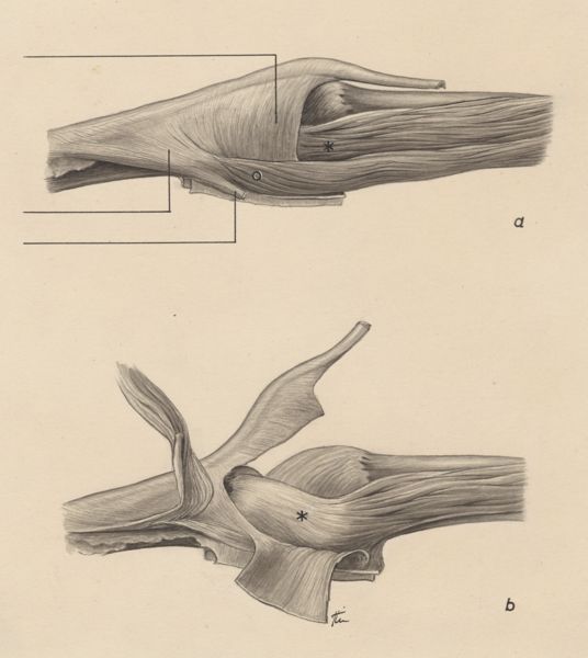 J Tinkelenberg, Muscular tissue of the finger