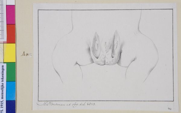 M Houtman, Genitals, hermaphrodite